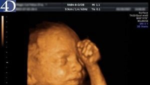 Hamilelik sırasında 4D ultrason