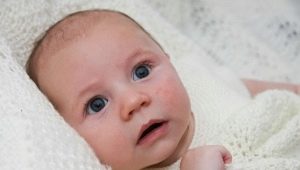 유아의 열 손실과 알레르기를 구별하는 방법은 무엇입니까?