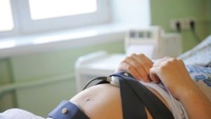 Tolkning av CTG under graviditeten