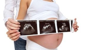Ultraljud i graviditetens 31: e vecka: fostrets storlek och andra egenskaper