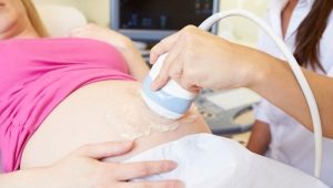 Orsaker och behandling av hematom i tidig graviditet