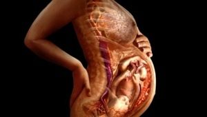 Orsaker till en tunn placenta under graviditeten och effekterna av hypoplasi
