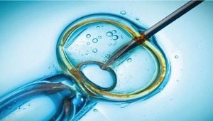 ICSI nedir? - intracytoplasmik sperm enjeksiyonu, prosedür nasıl?