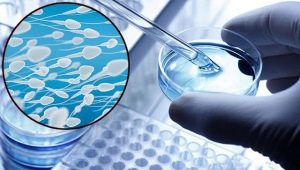 Normalde IVF için spermogram ne olmalı ve performansı nasıl geliştirmeli?