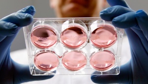 IVF'de embriyo transferi: işlem sonrası özellikler ve duyumlar