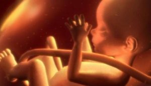 Kord fetal dolaşma: nedenleri ve sonuçları