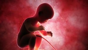 Typer av navelsträngsinfästningar och effekter på fostret