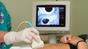 Wanneer begint het hart van de foetus te kloppen? Wanneer hoor je een hartslag of zie je het op een echografie?