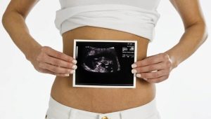Vad behöver du veta om graviditetens första trimester?