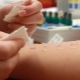 Alergické testy pre deti a ich typy