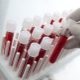 Dekódovanie krvných testov u detí