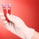 Sérologický krvný test na hepatitídu, HIV, syfilis a iné ochorenia