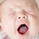 القلاع في الفم عند الأطفال حديثي الولادة والرضع