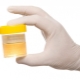 Turbid urine in a child