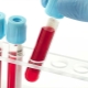 O dedičstve krvnej skupiny. Aký typ krvi bude mať dieťa?