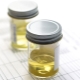 Algemene urine-analyse bij kinderen: transcript in de tabel