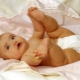 Physiological jaundice in newborns