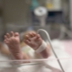 Rusya'da prematüre bebekler için yardım