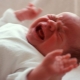 Skala APGAR: tafsiran jumlah bayi baru lahir dalam jadual