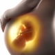 Fetal hipoksi: Çocuk için sonuçları