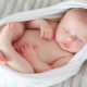 Hernia bij pasgeborenen en zuigelingen