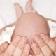 Was ist, wenn das Baby trockene Kopfhaut hat?