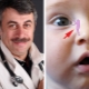 Dr. Komarovsky on the massage of the lacrimal canal in newborns