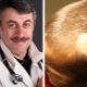 Dr. Komarovsky, çocuklarda saç dökülmesinin nedenleri hakkında