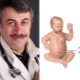 Dr. Komarovsky about umbilical hernia in newborns and small children