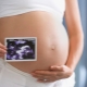 Hoe laat is de derde echografie tijdens de zwangerschap en op welke percentages van indicatoren gericht?