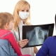 Symptoms and treatment of tuberculosis in children