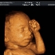 임신 중 4D 초음파