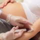 Analys av blodsocker hos gravida kvinnor: normer och orsaker till avvikelser
