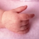 Why can a rash appear in the hands of a child and what to do?