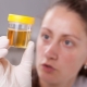 Leveransvillkor för urinanalys under graviditeten