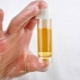 Orsaker och effekter av förhöjda nivåer av socker i urinen under graviditeten