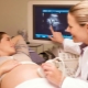 Ultraljud under den 13: e veckan av graviditeten: fostrets storlek och andra egenskaper