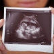 Ultraljud under den 20: e veckan av graviditeten: fostrets storlek och andra egenskaper