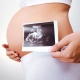 Echografie in de 22e week van de zwangerschap: foetale grootte en andere kenmerken