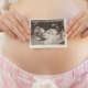Hamileliğin 30. haftasında ultrason: fetal boyut ve diğer özellikler