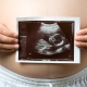 Ultraljud i den 33: e veckan av graviditeten: fostrets storlek och andra egenskaper