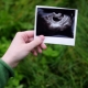 Ultraljud vid 4 veckors graviditet