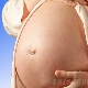 38 veckors graviditet: urladdning och smärta i buken