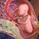 Ako vyzerá placenta a kde je pripojená?