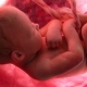 Wanneer begint een baby in de baarmoeder te horen?