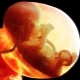 Oorzaken en effecten van voortijdige veroudering van de placenta