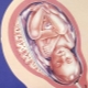Hrúbka placenty podľa týždňa tehotenstva