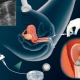 IVF'de embriyo implantasyonu.Başarı şansı nasıl arttırılır?