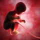 Typer av navelsträngsinfästningar och effekter på fostret