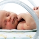 Vad är hypoxi och vilka effekter kan en nyfödd ha? Symtom och behandling